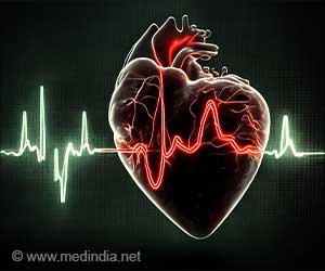 2022年心脏病死亡人数将增加12.5%